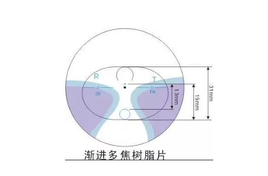 美麗島多焦鏡適合的人群，需要注意的事項